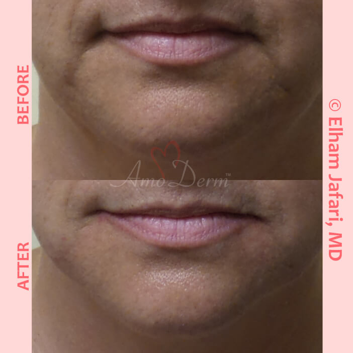 Lines Common Concerns