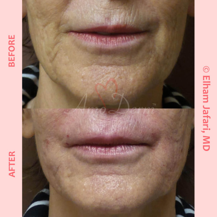 Lines Common Concerns