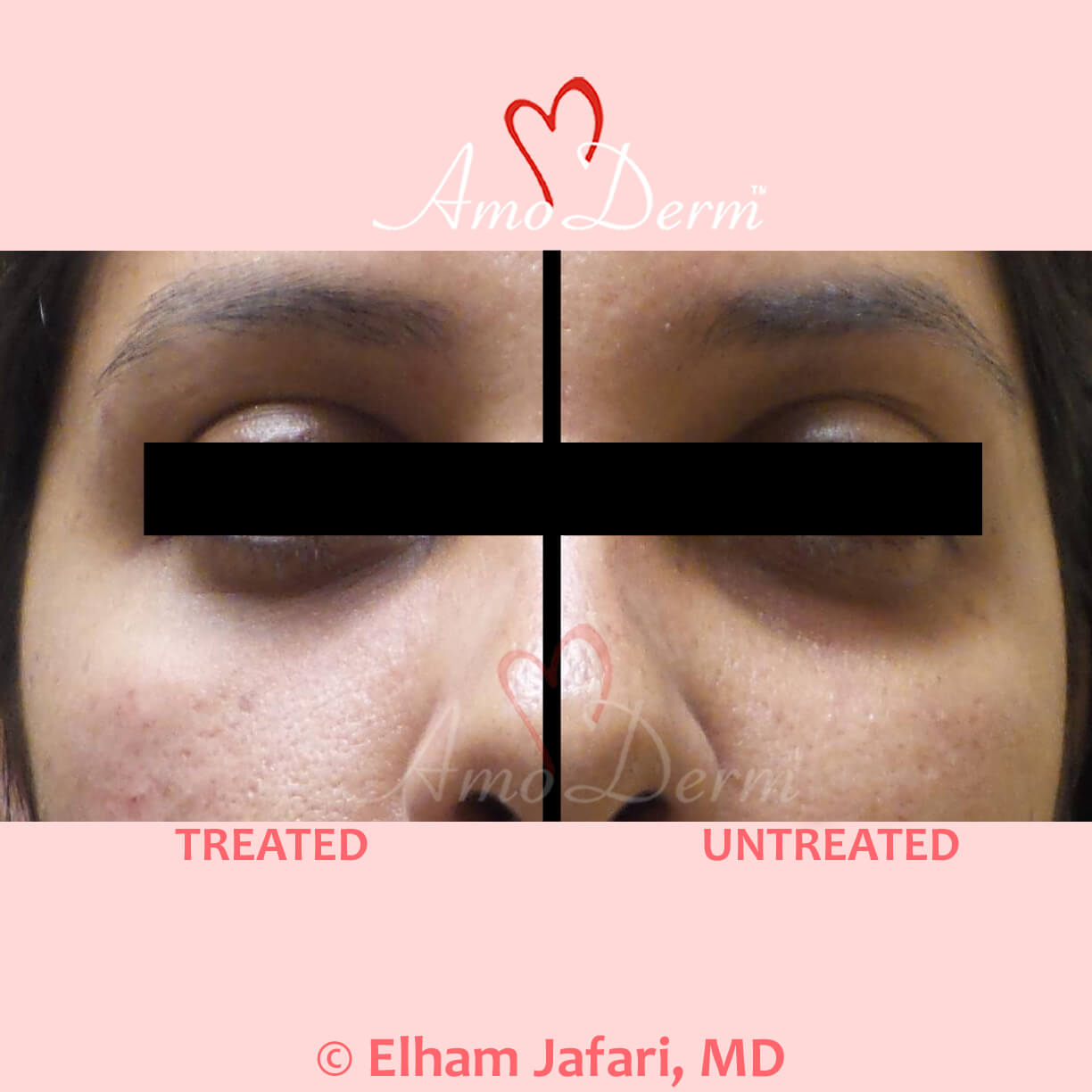 Lines Common Concerns