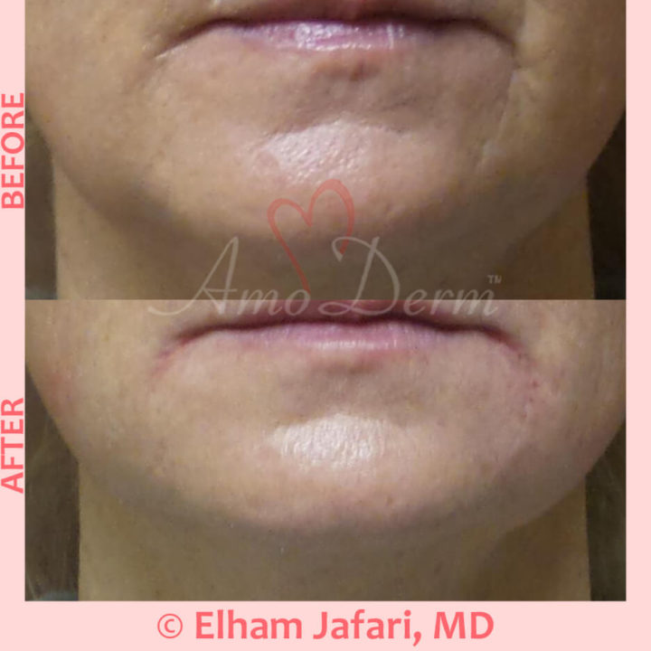 Lines Common Concerns