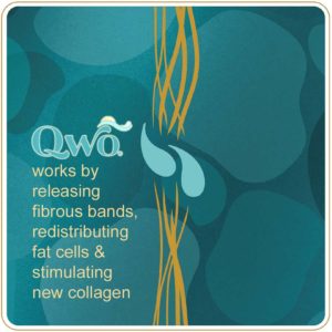 How qwo works