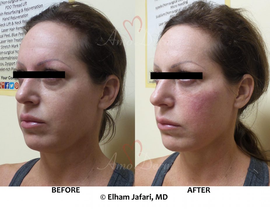 download dark circles under eyes treatment download dark circles under eyes treatment