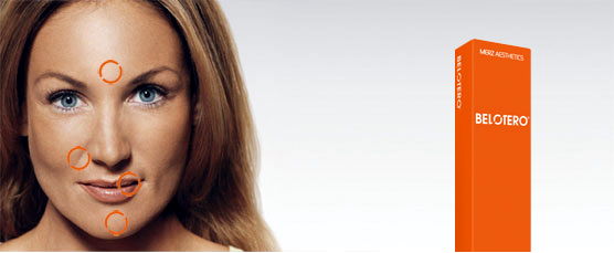 Belotero dermal filler