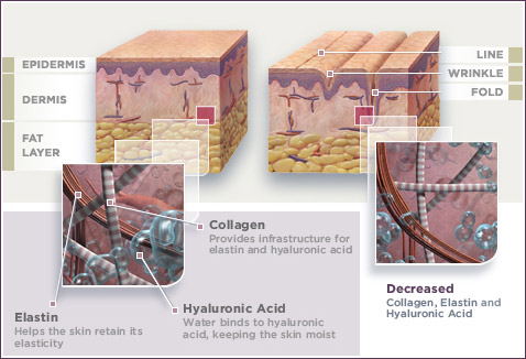 Dermal Fillers & Skin