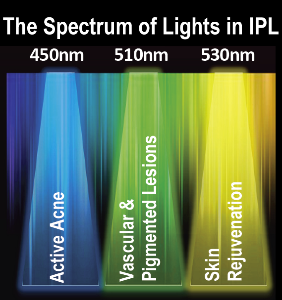 IPL Photofacial Spectrum