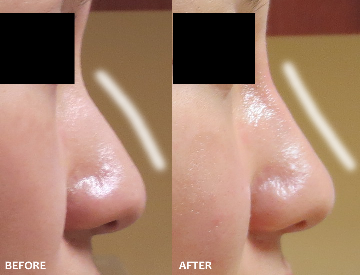 Amoderm : Before & After Gallery