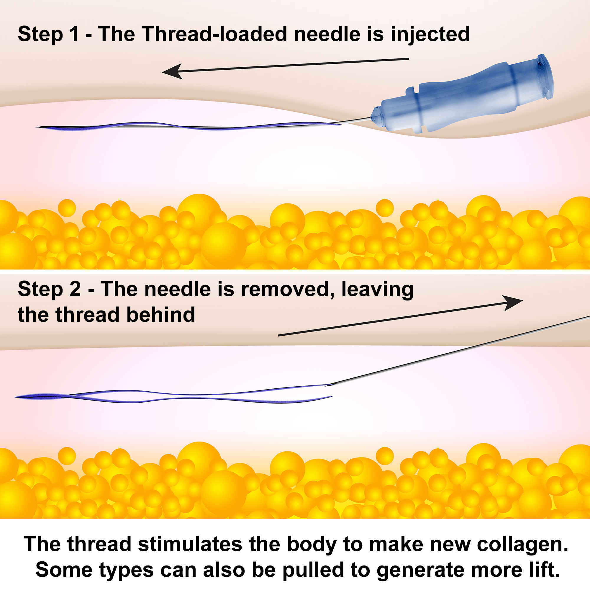 Loaded thread. Outer thread process.