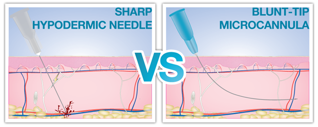 sharp hypodermic needle vs blunt-tip microcannula